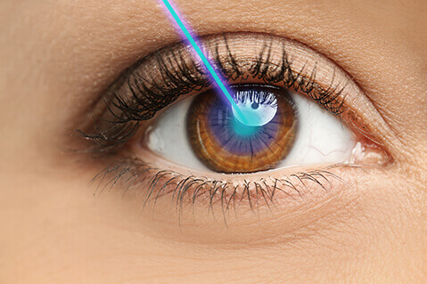 Glaucoma Laser Treatment