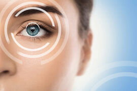 LASIK Technology Photo