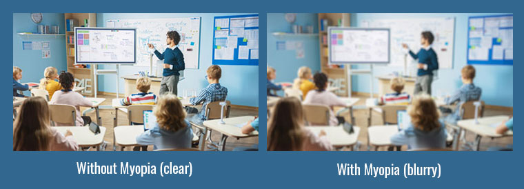 Graphic of Vision with and without myopia